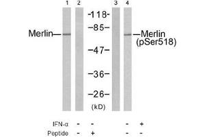 Image no. 2 for anti-Neurofibromin 2 (NF2) (pSer518) antibody (ABIN197028)