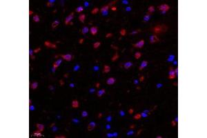 Immunofluorescence of paraffin embedded rat substantia nigra using C1orf173 (ABIN7074073) at dilution of 1: 650 (400x lens) (Glutamate-Rich Protein 3 (ERICH3) 抗体)