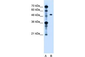Western Blotting (WB) image for anti-Zinc Finger, FYVE Domain Containing 27 (ZFYVE27) antibody (ABIN2462817) (ZFYVE27 抗体)
