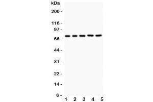Western blot testing of RIP1 antibody and Lane 1:  Jurkat;  2: 22RV1;  3: MCF-7;  4: HeLa;  5: A549. (RIPK1 抗体  (AA 316-671))
