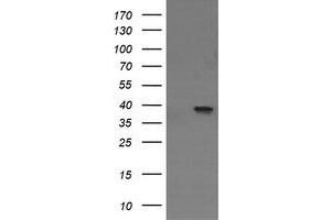 Image no. 1 for anti-Mitogen-Activated Protein Kinase Kinase 3 (MAP2K3) antibody (ABIN1499415) (MAP2K3 抗体)