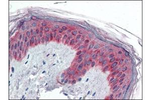 Human Skin (formalin-fixed, paraffin-embedded) stained with VAV3at 5 µg/ml followed by biotinylated anti-goat IgG secondary antibody, alkaline phosphatase-streptavidin and chromogen. (VAV3 抗体  (Internal Region))