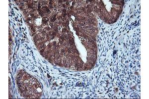 Image no. 1 for anti-Haloacid Dehalogenase-Like Hydrolase Domain Containing 1 (HDHD1) antibody (ABIN1498625) (HDHD1 抗体)