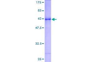 Image no. 1 for Thiosulfate Sulfurtransferase (Rhodanese) (TST) (AA 1-297) protein (GST tag) (ABIN1323989) (TST Protein (AA 1-297) (GST tag))