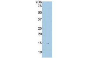 WB of Protein Standard: different control antibodies  against Highly purified E. (S100B ELISA 试剂盒)