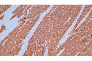 Detection of MBP in Human Cerebrum Tissue using Monoclonal Antibody to Myelin Basic Protein (MBP) (MBP 抗体  (AA 220-301))