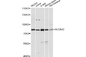 Western blot analysis of extracts of various cell lines, using SLC26A2 antibody. (SLC26A2 抗体)