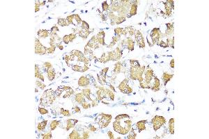Immunohistochemistry of paraffin-embedded Human stomach using XBP1s antibody (ABIN7271399) at dilution of 1:100 (40x lens). (XBP1 抗体  (AA 300-376))