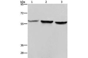 Western Blot analysis of Hela, A375 and LoVo cell using SYN2 Polyclonal Antibody at dilution of 1:1400 (SYN2 抗体)