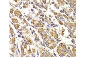 Immunohistochemistry of paraffin-embedded Human stomach using METTL7B Polyclonal Antibody at dilution of 1:100 (40x lens). (METTL7B 抗体)