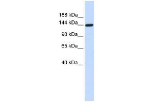 WB Suggested Anti-DAAM1 Antibody Titration: 0. (DAAM1 抗体  (Middle Region))