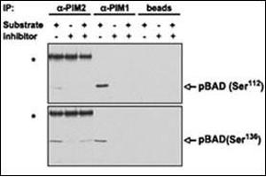 PIM proteins were immunoprecipitated from MV4,11 cells and the agarose-protein A-immunoprecipitate complex was tested for its ability to phosphorylate BAD in vitro in the presence or absence of . (PIM2 抗体  (C-Term))