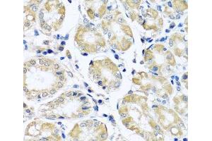 Immunohistochemistry of paraffin-embedded Human stomach using NDUFB10 Polyclonal Antibody at dilution of 1:100 (40x lens). (NDUFB10 抗体)