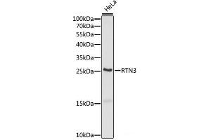 Western blot analysis of extracts of HeLa cells using RTN3 Polyclonal Antibody at dilution of 1:1000. (Reticulon 3 抗体)