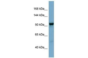 NDST4 antibody used at 1 ug/ml to detect target protein. (NDST4 抗体)