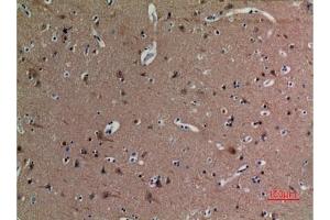 Immunohistochemical analysis of paraffin-embedded human-brain, antibody was diluted at 1:100. (alpha Tubulin 抗体  (acLys40))