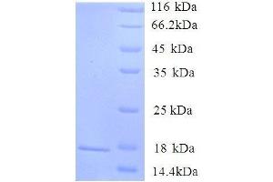 SDS-PAGE (SDS) image for Sortilin 1 (SORT1) (AA 610-754) protein (His tag) (ABIN7479082)
