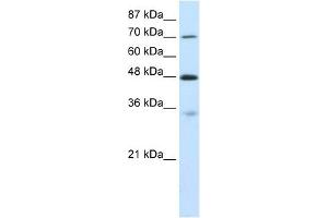 CARS antibody used at 0. (CARS 抗体  (C-Term))