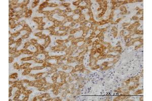 Immunoperoxidase of monoclonal antibody to UBE2G2 on formalin-fixed paraffin-embedded human liver. (UBE2G2 抗体  (AA 1-87))