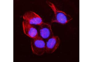 IF analysis of non-muscle Myosin IIB/MYH10 using anti-non-muscle Myosin IIB/MYH10 antibody (ABIN7603186). (MYH10 抗体  (N-Term))