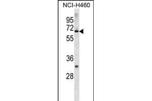 ZN Antibody (N-term) (ABIN1882016 and ABIN2838710) western blot analysis in NCI- cell line lysates (35 μg/lane).