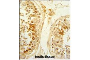 Formalin-Fixed and paraffin-Embedded Human testis tissue reacted with SFRP1 Antibody (N-term), which was peroxidase-conjugated to the secondary antibody, followed by DAB staining. (SFRP1 抗体  (N-Term))