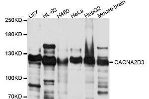 Western blot analysis of extract of various cells, using CACNA2D3 antibody. (CACNA2D3 抗体)