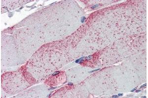 Skeletal muscle (OB Cadherin 抗体  (Intracellular))