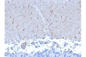 Formalin-fixed, paraffin-embedded human Brain stained with ATG5 Mouse Monoclonal Antibody (ATG5/2553). (ATG5 抗体  (AA 1-119))