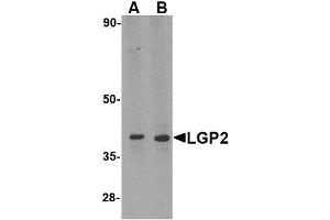 Image no. 1 for anti-DEXH (Asp-Glu-X-His) Box Polypeptide 58 (DHX58) (N-Term) antibody (ABIN1494350) (DHX58 抗体  (N-Term))