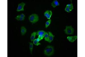 Immunofluorescence staining of MCF-7 cells with ABIN7127824 at 1:39, counter-stained with DAPI. (Recombinant Src 抗体)