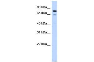 RMI1 antibody used at 1 ug/ml to detect target protein. (RMI1 抗体)