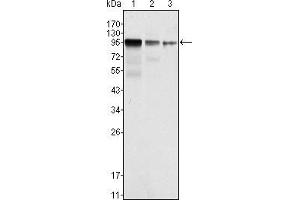 Western blot analysis using FER mouse mAb against NIH/3T3 (1), A549 (2) and SK-MEL-5 (3) cell lysate. (FER 抗体)