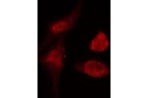 ABIN6274990 staining  COLO205 cells by IF/ICC. (CEP57 抗体  (Internal Region))