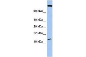 Image no. 1 for anti-Chromosome 5 Open Reading Frame 64 (C5ORF64) (AA 71-120) antibody (ABIN6743861) (C5ORF64 抗体  (AA 71-120))