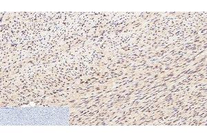 Immunohistochemistry of paraffin-embedded Human uterus tissue using Lamin B1 Monoclonal Antibody at dilution of 1:200. (Lamin B1 抗体)