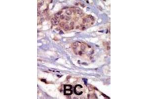 Immunohistochemistry (IHC) image for anti-FYN Oncogene Related To SRC, FGR, YES (FYN) antibody (ABIN3003445) (FYN 抗体)