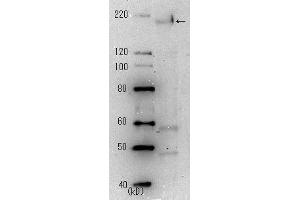 Western Blotting (WB) image for anti-SARS-Coronavirus Spike Protein (SARS-CoV S) antibody (ABIN2452119) (SARS-CoV Spike 抗体)