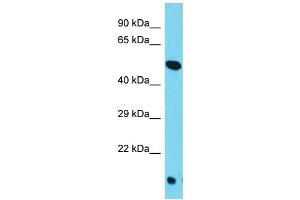 Host: Rabbit Target Name: TOR4A Sample Type: HepG2 Whole Cell lysates Antibody Dilution: 1. (TOR4A 抗体  (C-Term))