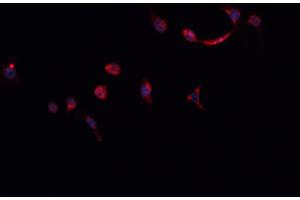 ABIN6268824 staining HeLa cells by IF/ICC. (HNRNPM 抗体  (N-Term))