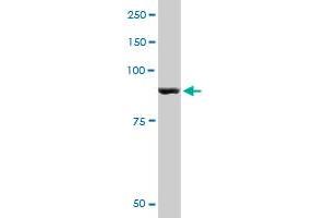 PYGM monoclonal antibody (M10), clone 2C4. (PYGM 抗体  (AA 734-842))