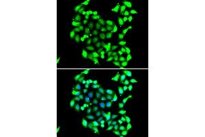 Immunofluorescence analysis of A549 cells using GTF2H3 antibody. (GTF2H3 抗体)