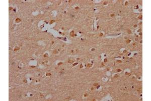 IHC image of ABIN7166499 diluted at 1:200 and staining in paraffin-embedded human brain tissue performed on a Leica BondTM system. (Src 抗体  (AA 2-100))