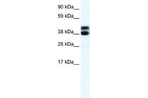 WB Suggested Anti-RFP2 Antibody Titration:  0. (TRIM13 抗体  (Middle Region))
