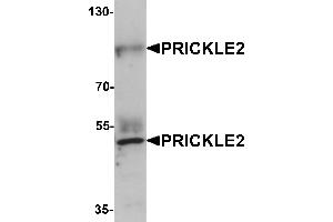Western blot analysis of PRICKLE2 in A-20 lysate with PRICKLE2 antibody at 1 µg/mL. (PRICKLE2 抗体  (Middle Region))