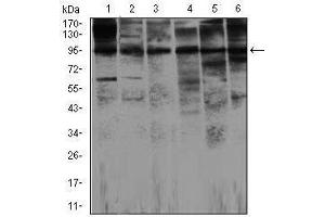 Western Blotting (WB) image for anti-Nitric Oxide Synthase 2, Inducible (NOS2) antibody (ABIN1108478) (NOS2 抗体)