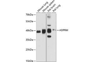 Western blot analysis of extracts of various cell lines, using ADPRM antibody (ABIN6131440, ABIN6136589, ABIN6136590 and ABIN6216678) at 1:3000 dilution. (ADPRM 抗体  (AA 203-342))