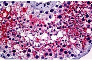 Anti-ACE-2 antibody IHC staining of human testis. (ACE2 抗体  (Internal Region))