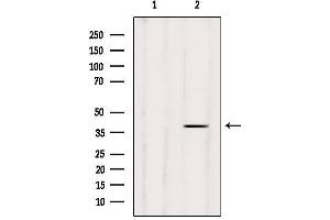 Western blot analysis of extracts from VERO, using AurB Antibody. (Aurora Kinase B 抗体)