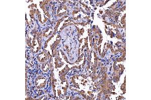 IHC analysis of LIN41/TRIM71 using anti-LIN41/TRIM71 antibody (ABIN7602565).